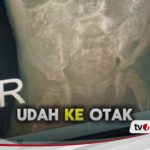 68a547a713803-nasib-pilu-anak-di-sukabumi-meninggal-dunia-gara-gara-cacingan-akut-cacing-15-cm-bisa-ditarik-dari-lubang-hidung-bapak-sakit-dan-ibu-odgj_488_274.jpg